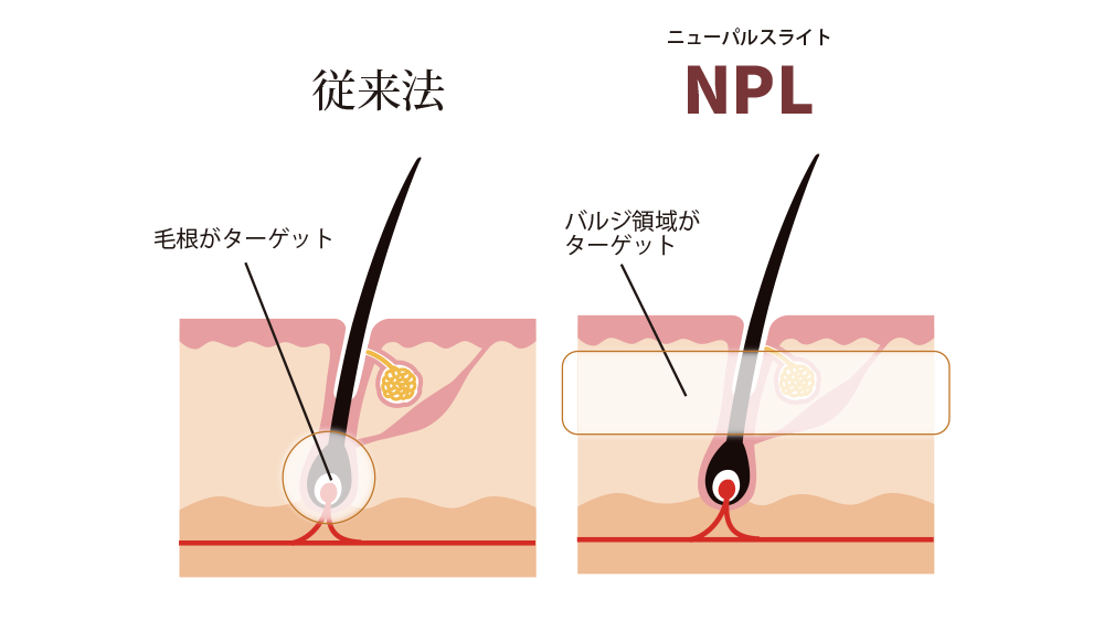 トータルビューティーサロン B-plus ビープラス